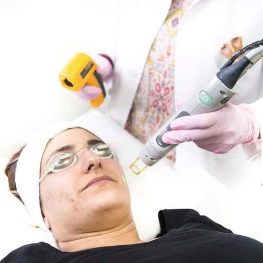 Laser Acne Treatment Viola Laser and Skin Care Clinic