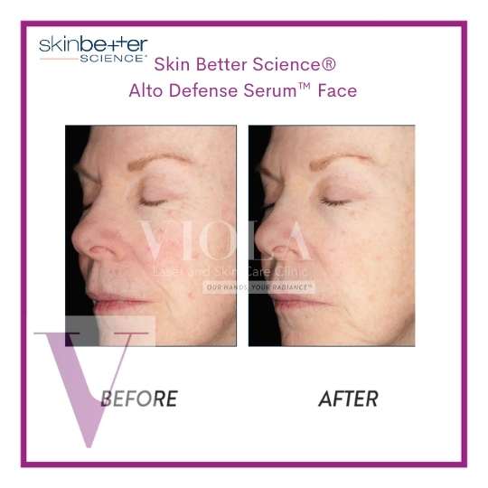 Skin Better Science Products in Toronto - Viola Laser and Skin Care Clinic